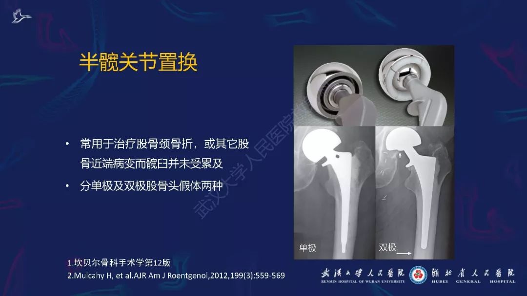 【PPT】肌骨MRI金属伪影抑制技术临床应用