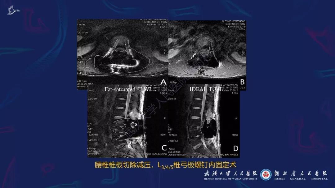 【PPT】肌骨MRI金属伪影抑制技术临床应用