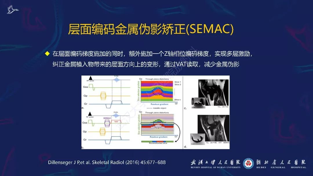 【PPT】肌骨MRI金属伪影抑制技术临床应用