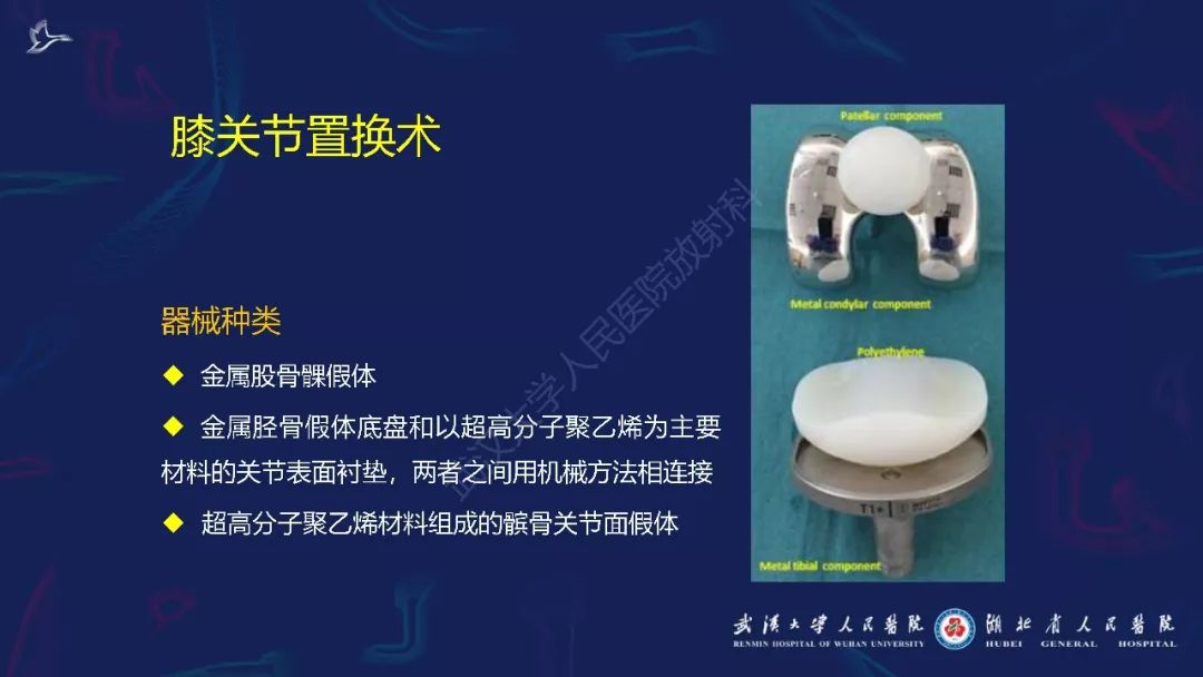 【PPT】肌骨MRI金属伪影抑制技术临床应用