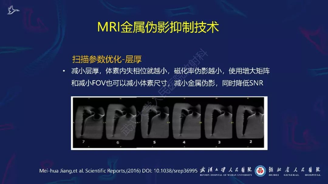 【PPT】肌骨MRI金属伪影抑制技术临床应用