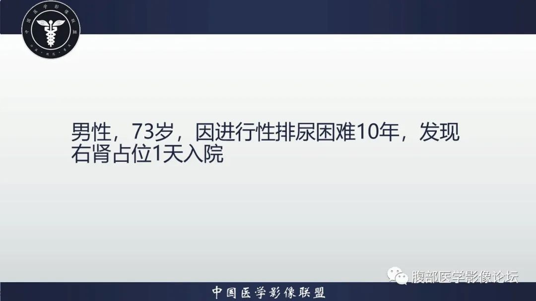 【病例】右肾嗜酸细胞腺瘤1例CT影像