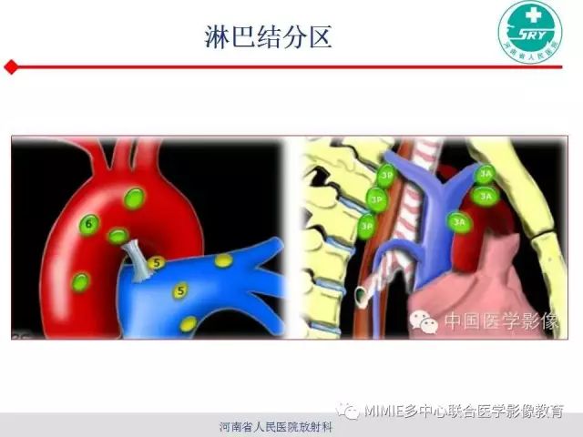 【PPT】胸部淋巴结分区及其在肺癌定性和分期诊断中的价值