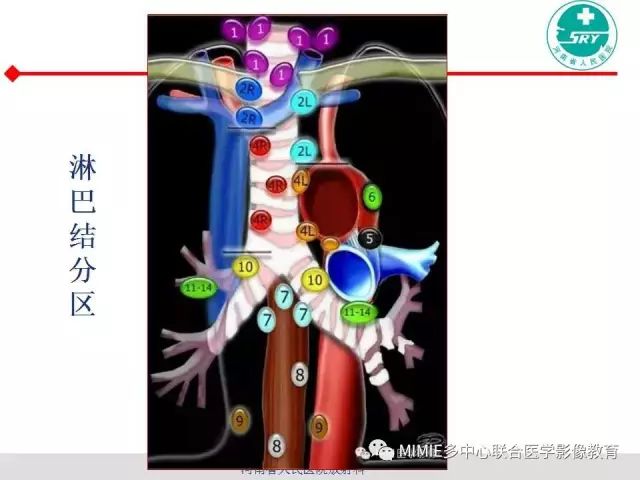 【PPT】胸部淋巴结分区及其在肺癌定性和分期诊断中的价值