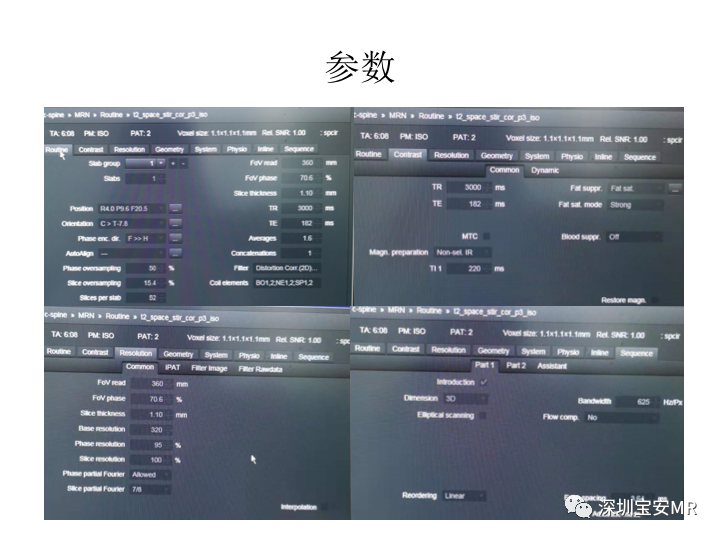 【PPT】臂丛神经MR扫描