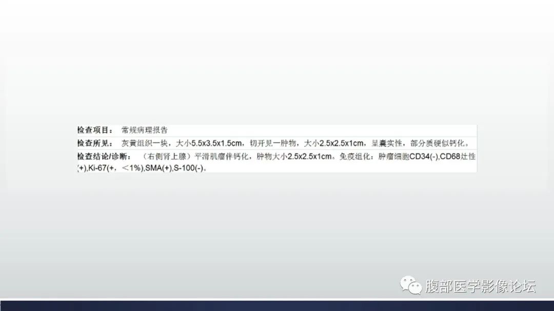 【病例】肾上腺平滑肌瘤伴钙化1例CT影像