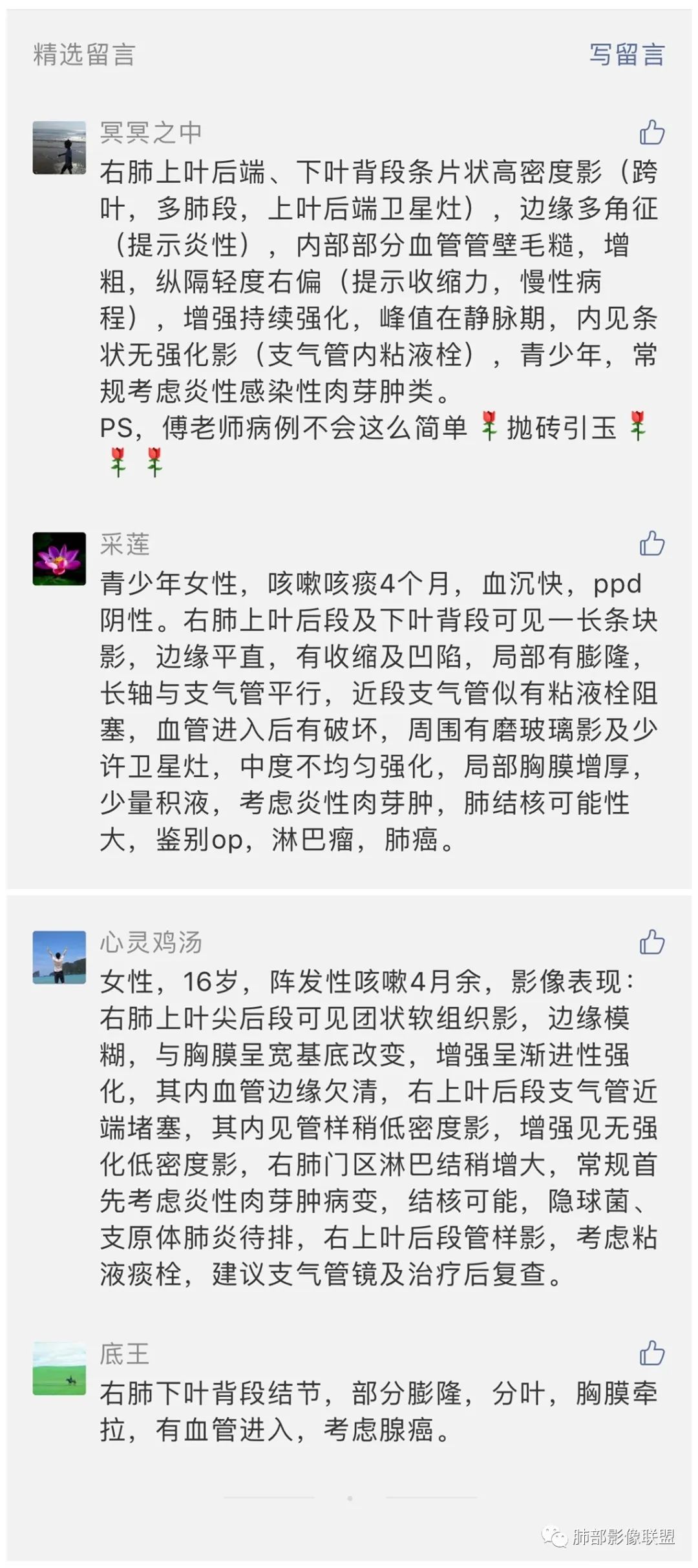 【病例】右肺炎症性病变1例CT影像讨论