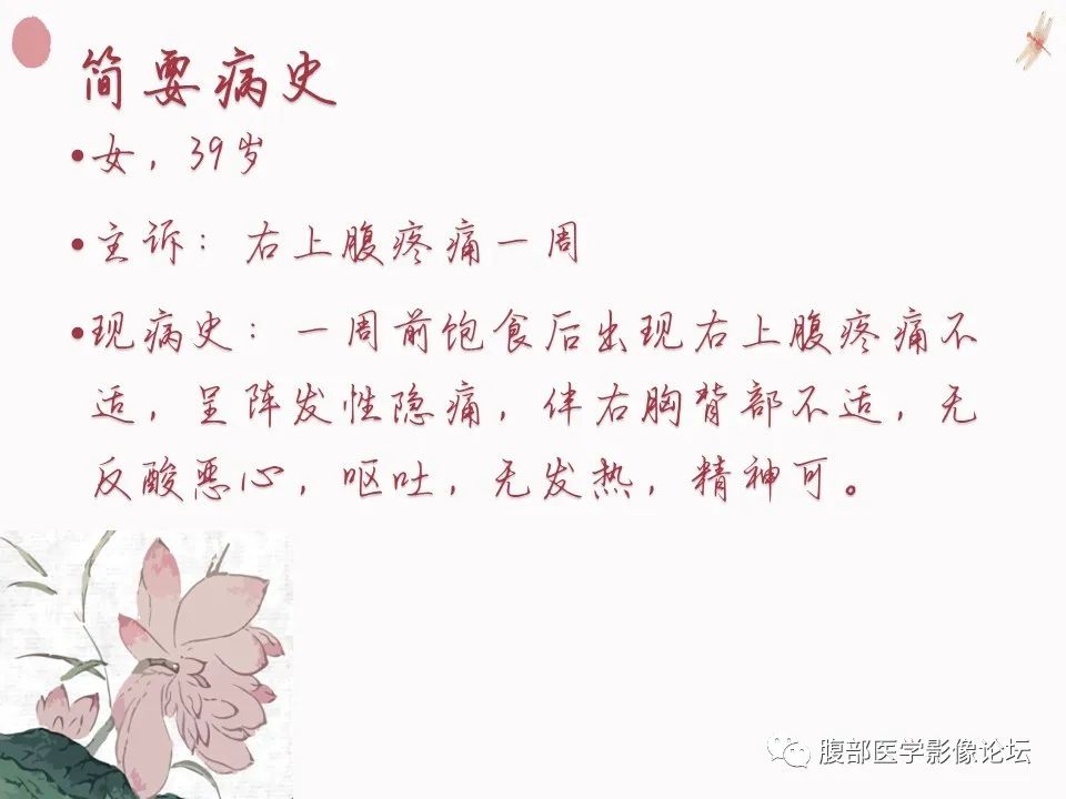 【PPT】肝脏良性囊肿影像诊断
