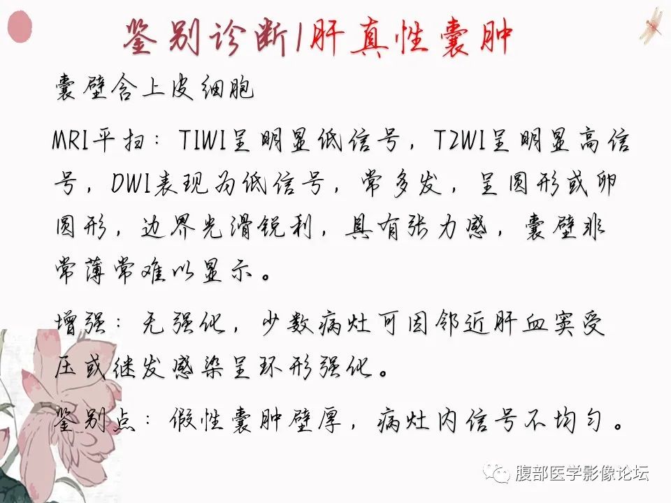 【PPT】肝脏良性囊肿影像诊断