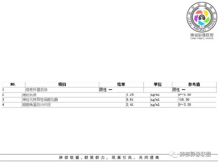 【病例】肺部实性小结节1例影像讨论分析