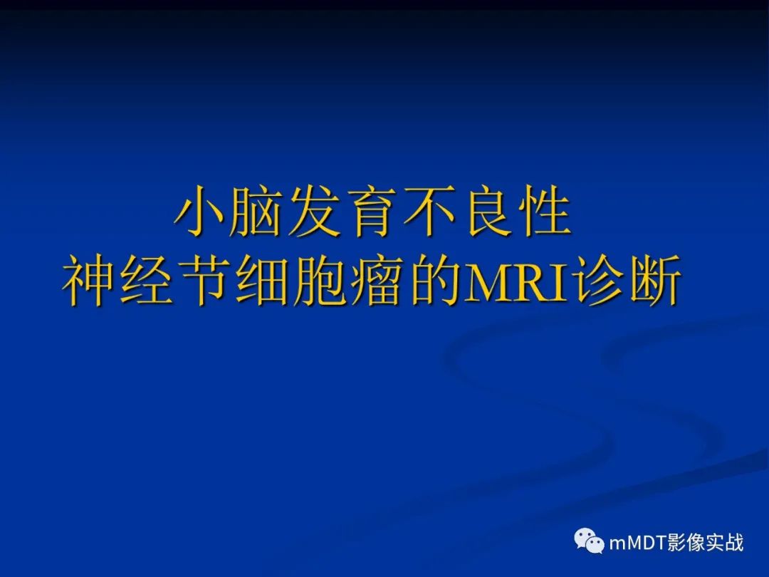 【PPT】小脑发育不良性神经节细胞瘤的MR诊断