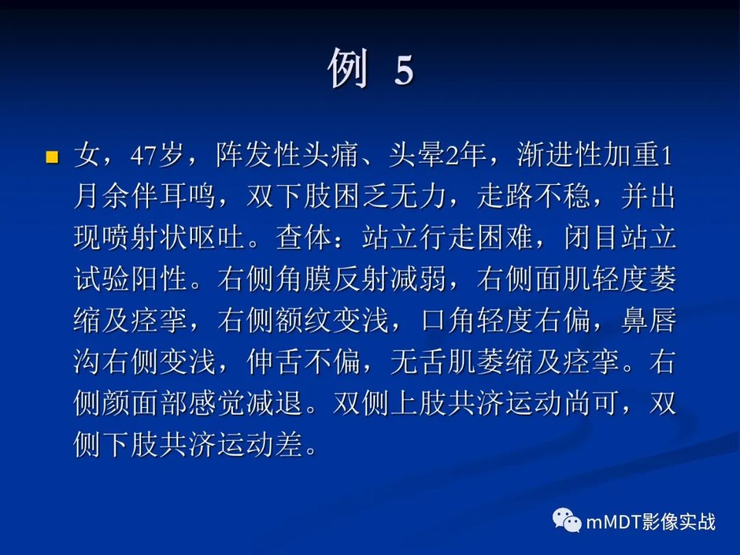 【PPT】小脑发育不良性神经节细胞瘤的MR诊断