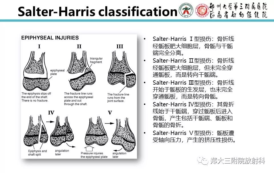 【PPT】骨骺损伤的影像诊断