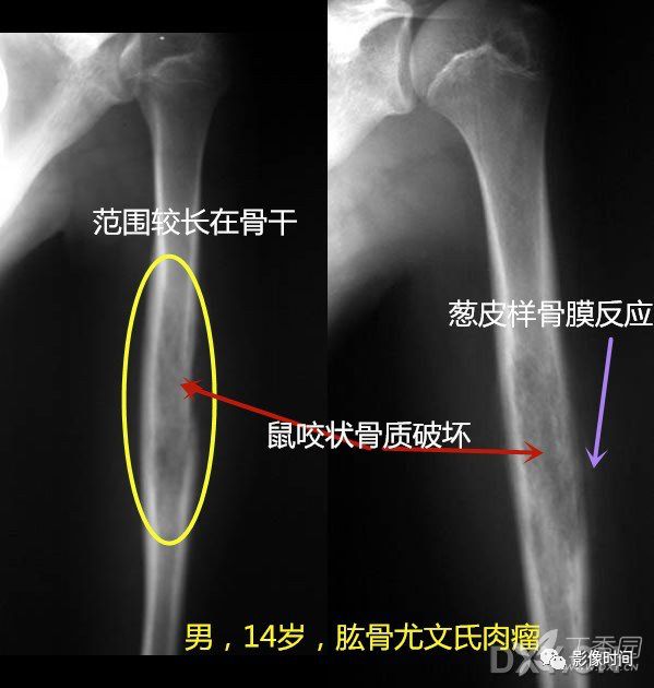 七大恶性骨肿瘤，背背诗就能了解啦！