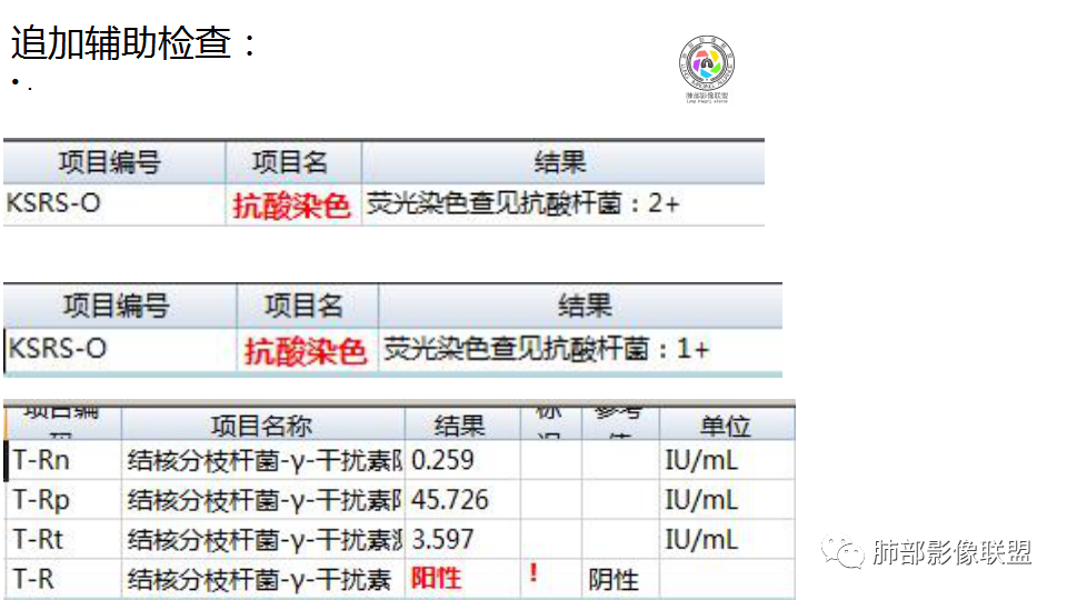 【病例】肺结核1例CT影像讨论