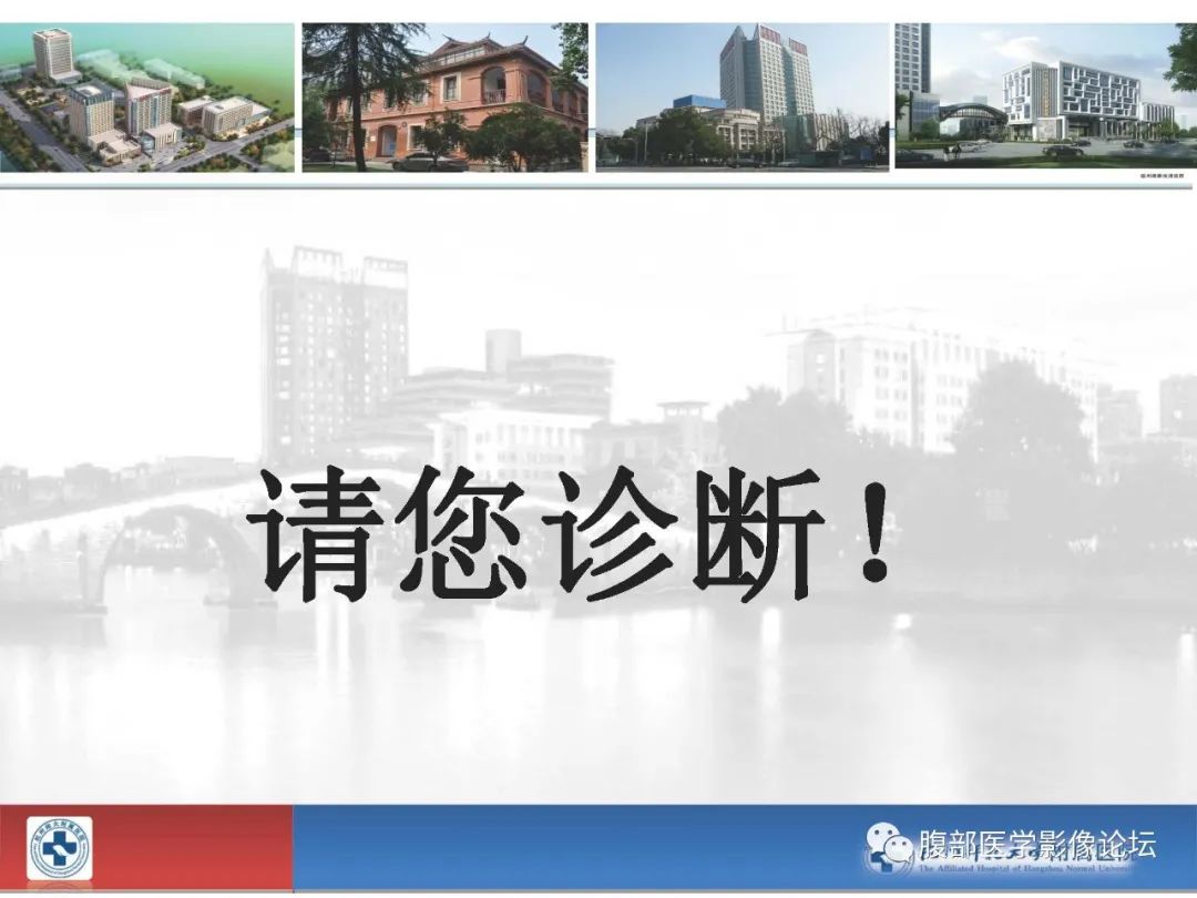 【病例】胰腺神经内分泌癌1例CT影像