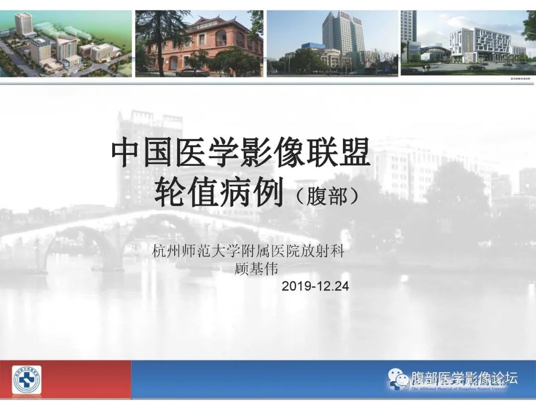 【病例】胰腺神经内分泌癌1例CT影像