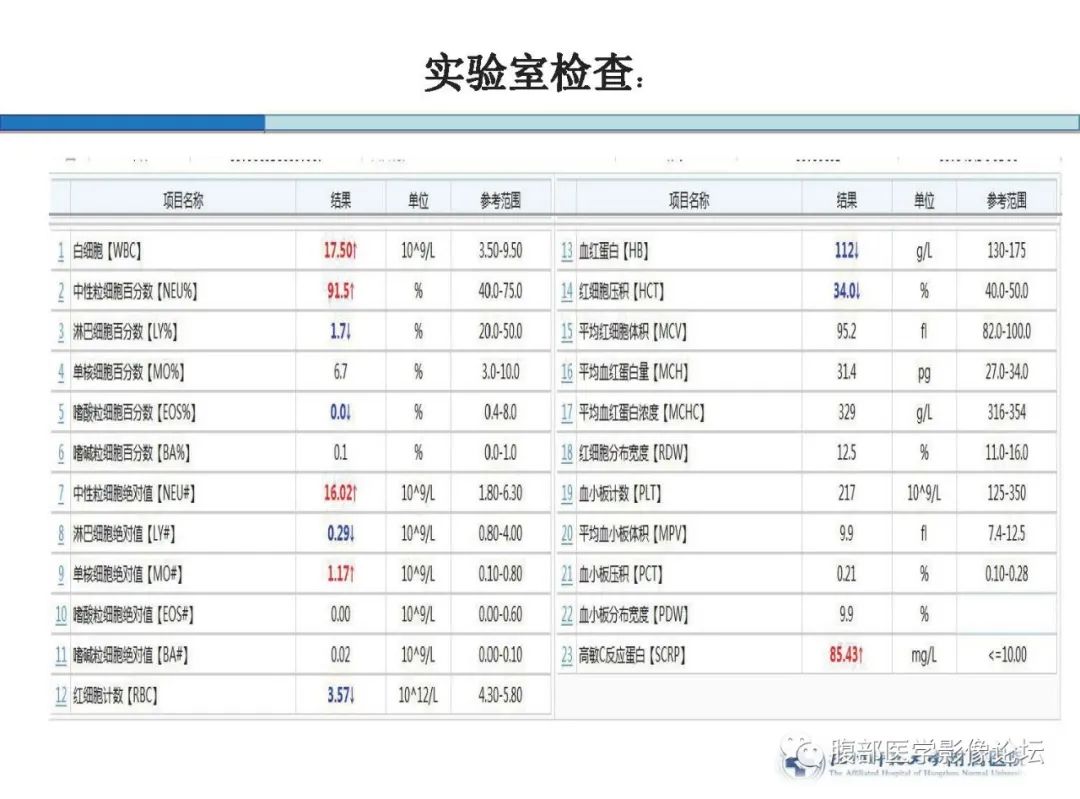 【病例】胰腺神经内分泌癌1例CT影像