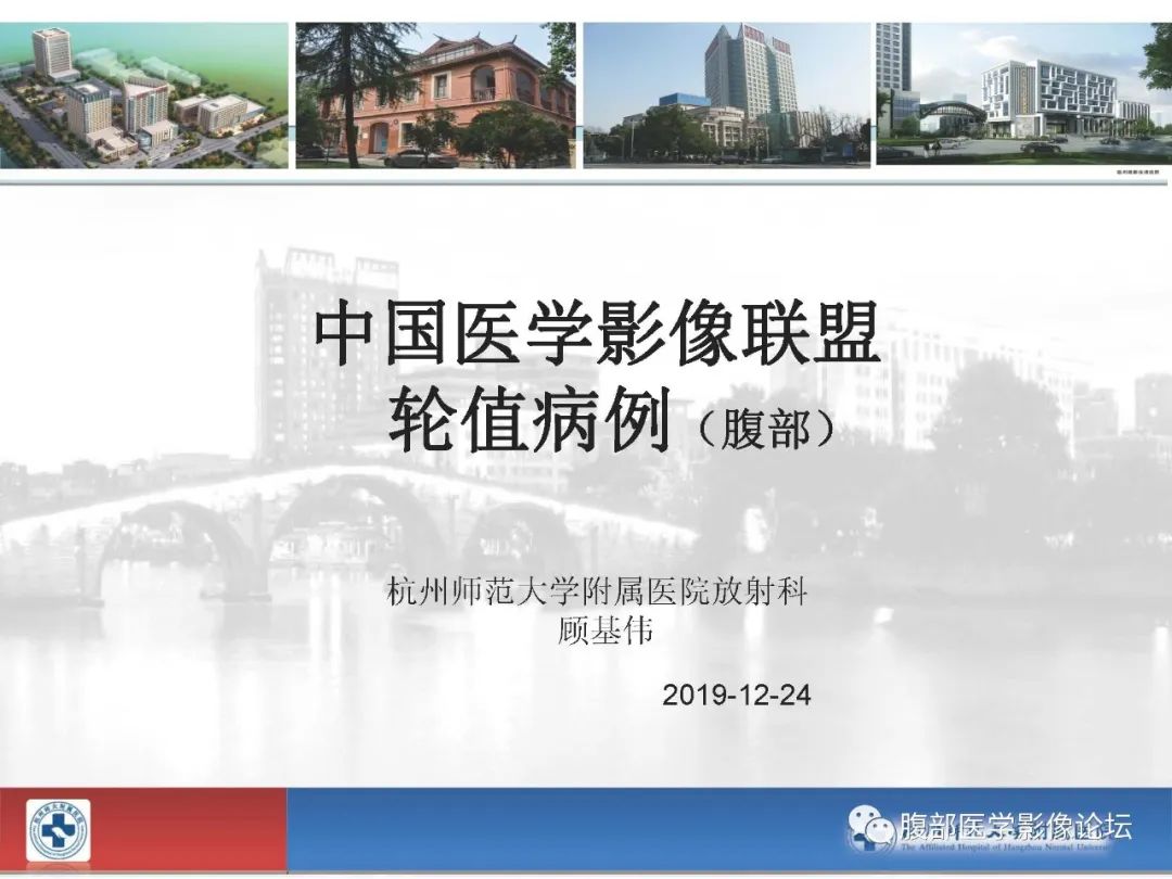 【病例】胰腺实性假乳头状肿瘤1例CT及MR