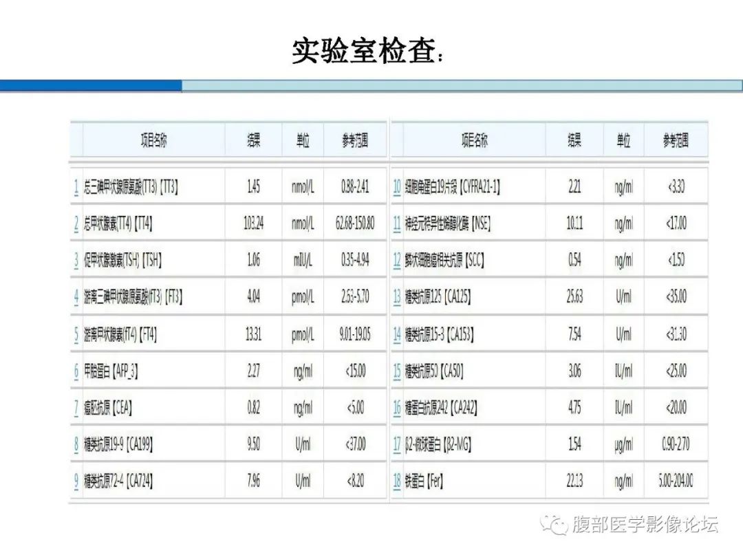 【病例】胰腺实性假乳头状肿瘤1例CT及MR