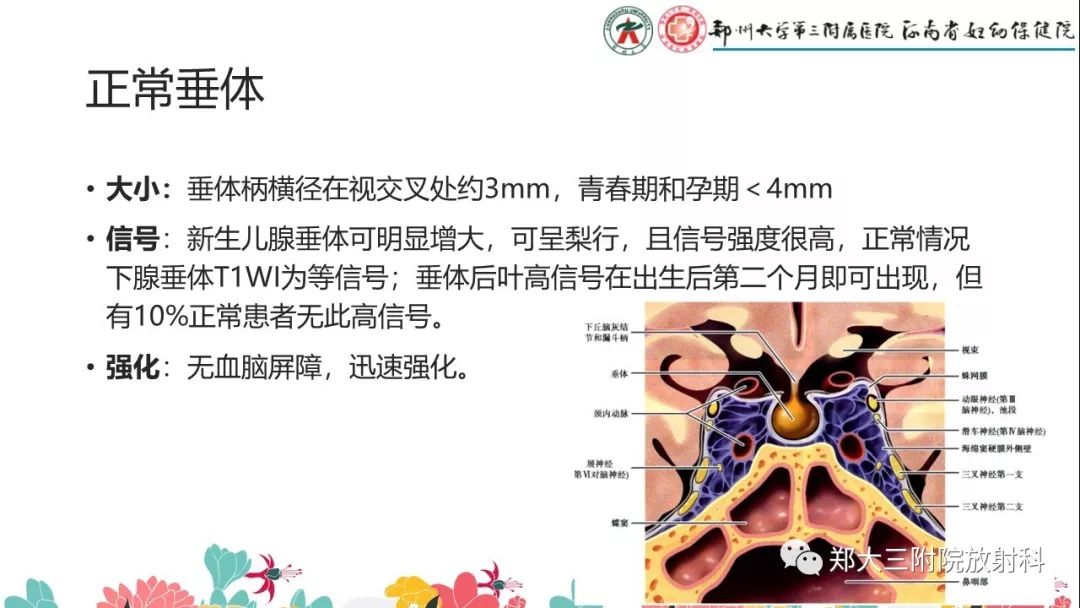 【PPT】先天性垂体发育不良