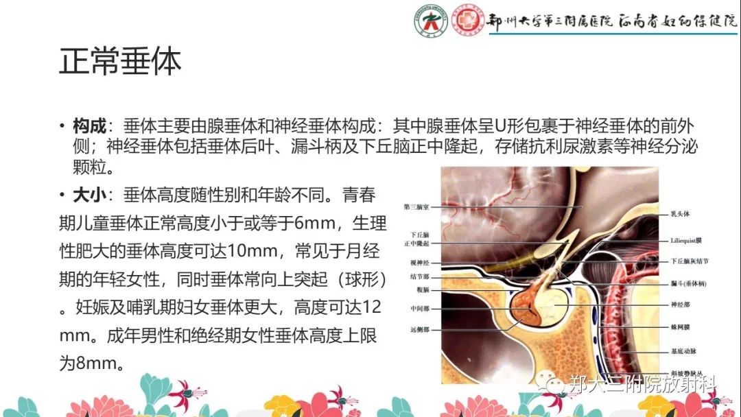 【PPT】先天性垂体发育不良