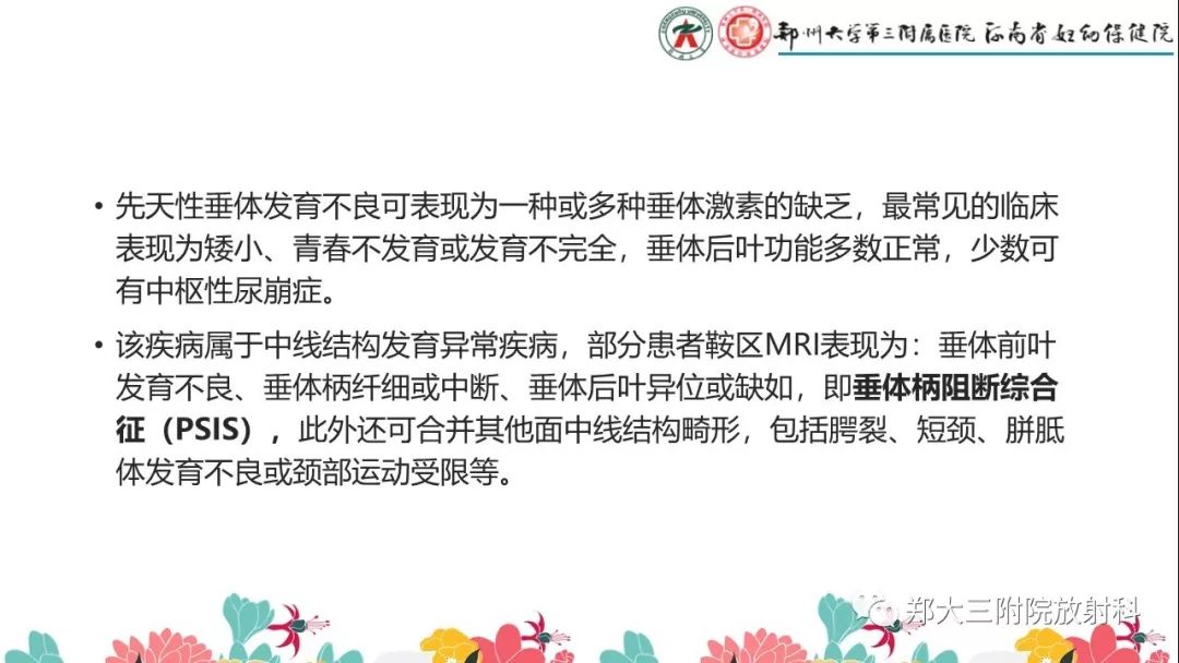 【PPT】先天性垂体发育不良