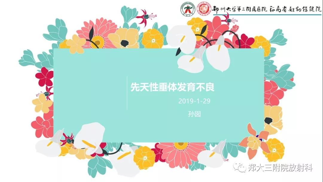 【PPT】先天性垂体发育不良
