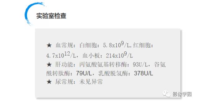 【病例】纵隔结核1例CT影像表现