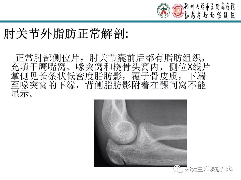 【PPT】儿童肘关节骨折的X线表现