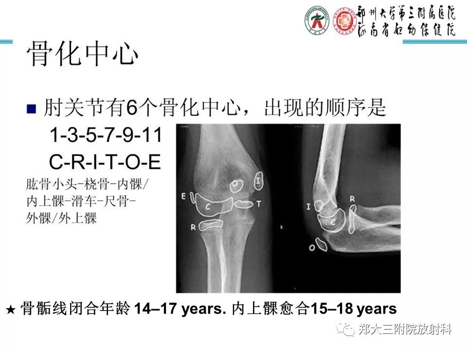 【PPT】儿童肘关节骨折的X线表现