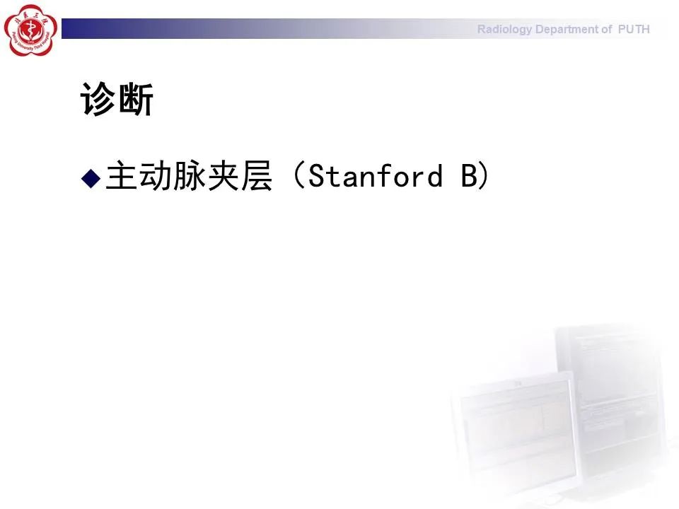 【PPT】主动脉夹层的影像