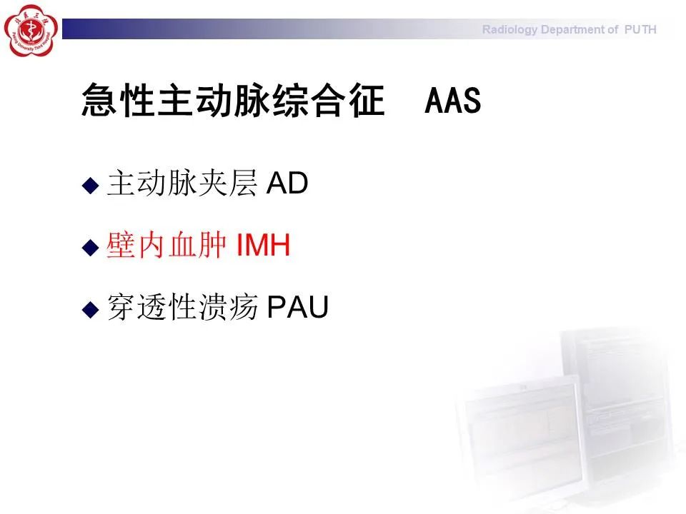 【PPT】主动脉夹层的影像