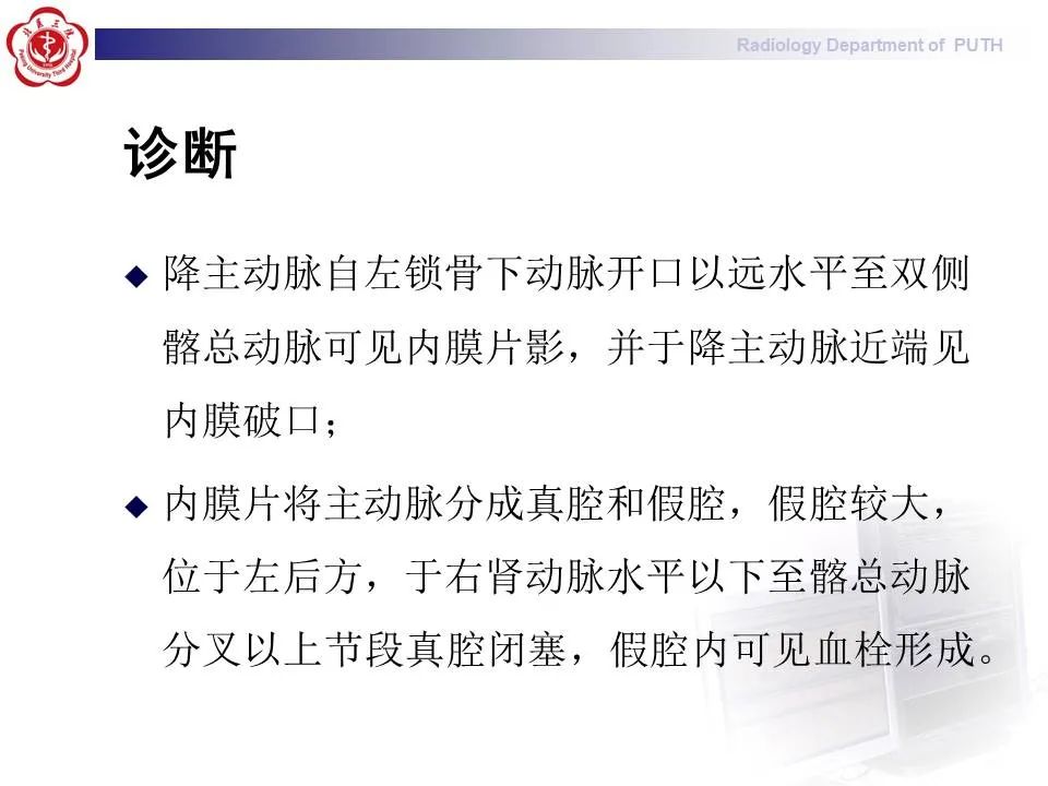 【PPT】主动脉夹层的影像
