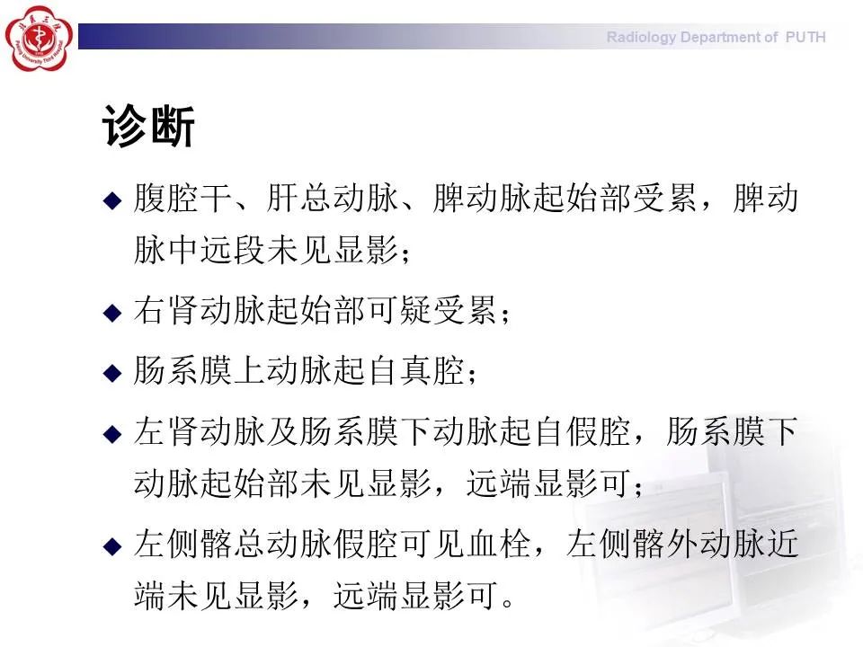 【PPT】主动脉夹层的影像