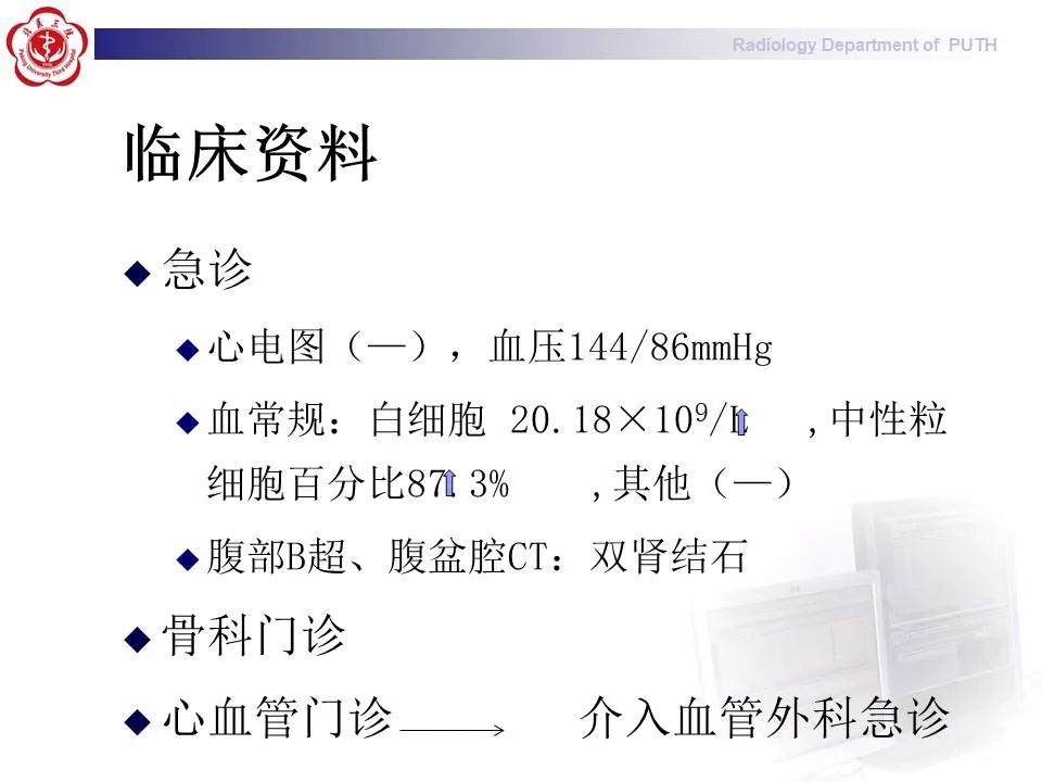 【PPT】主动脉夹层的影像