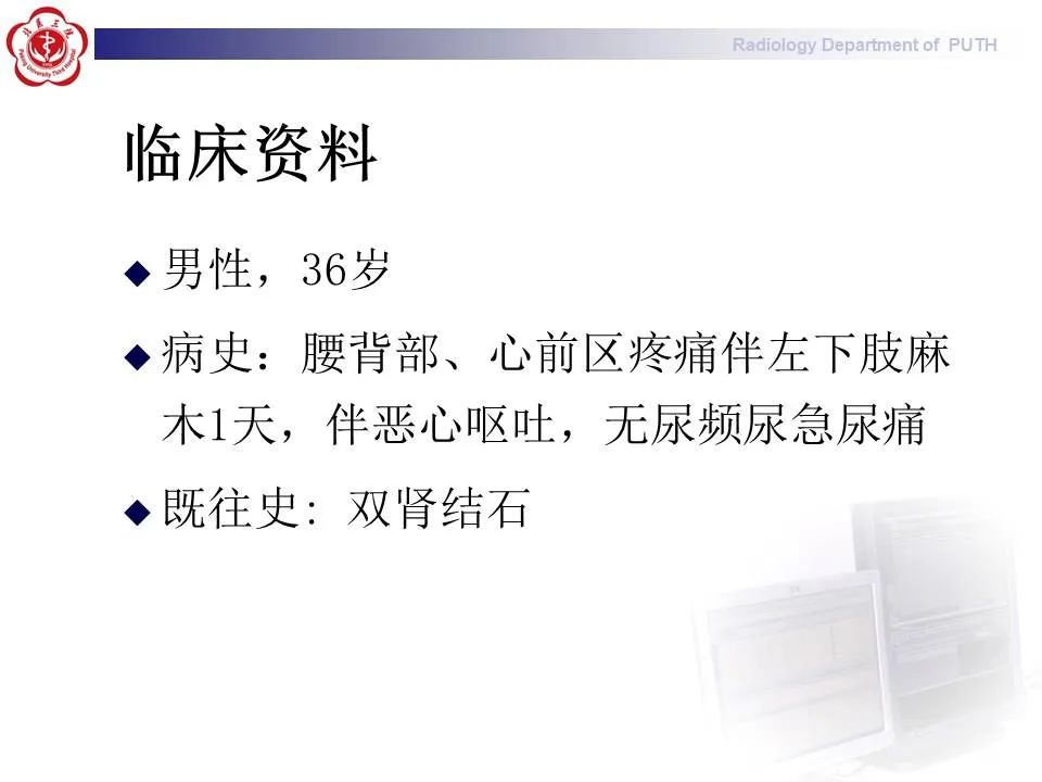 【PPT】主动脉夹层的影像