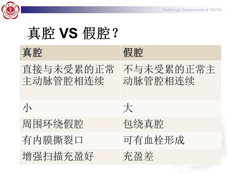 【PPT】主动脉夹层的影像