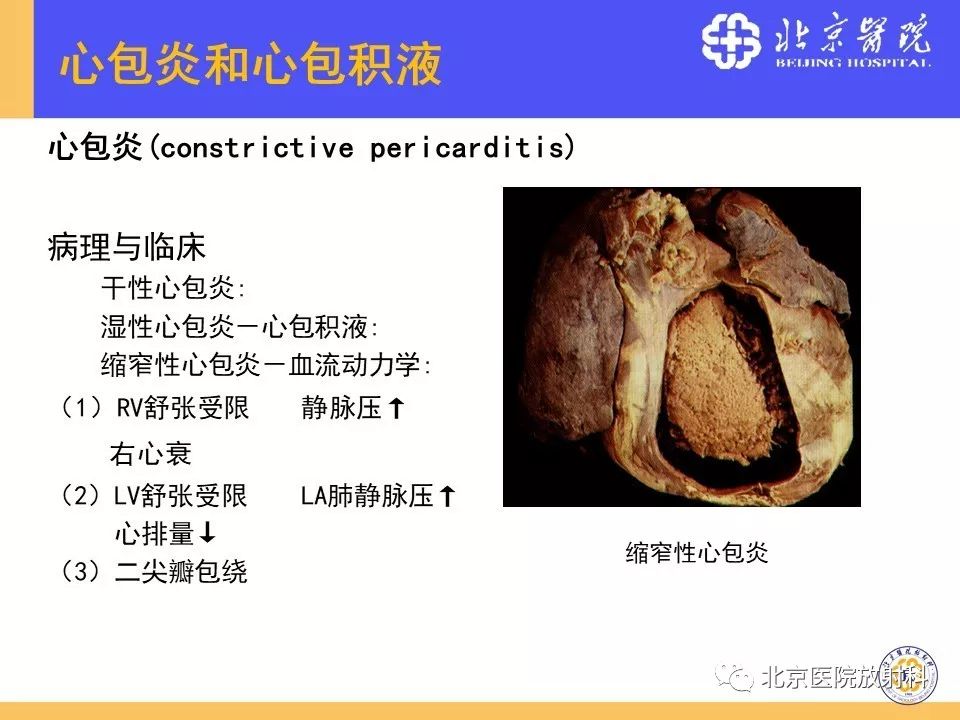 【PPT】心脏病变的影像诊断