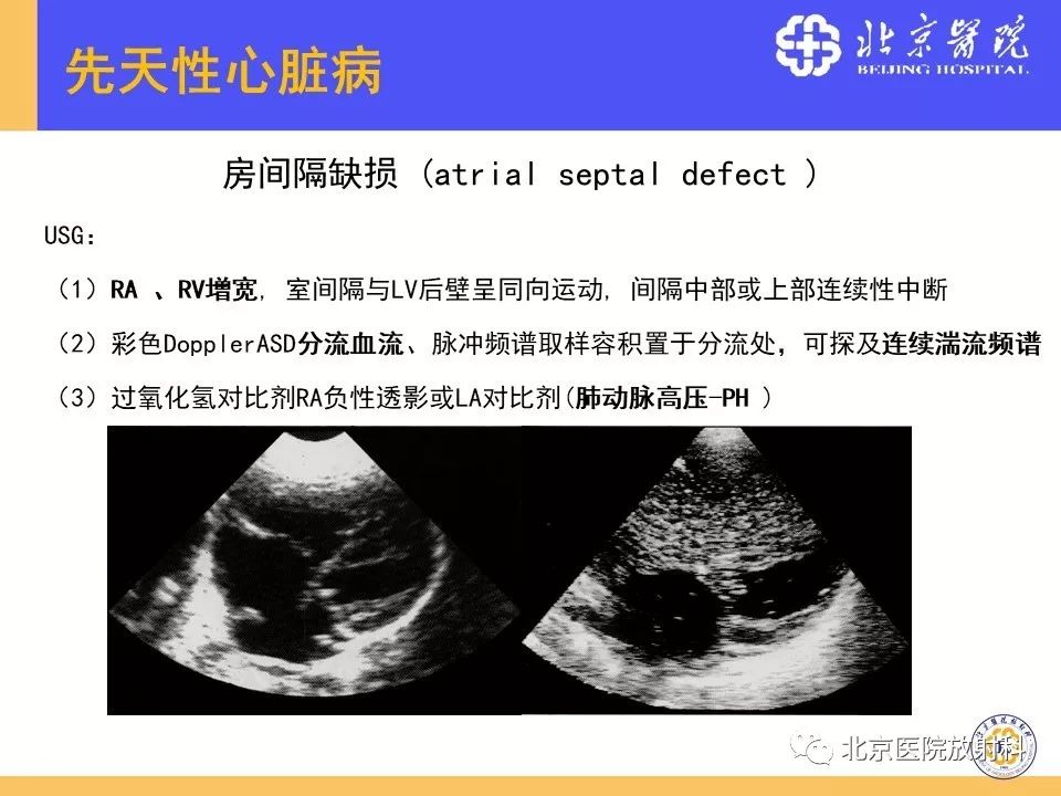 【PPT】心脏病变的影像诊断