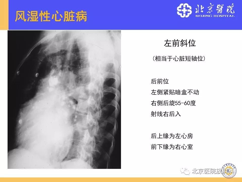 【PPT】心脏病变的影像诊断