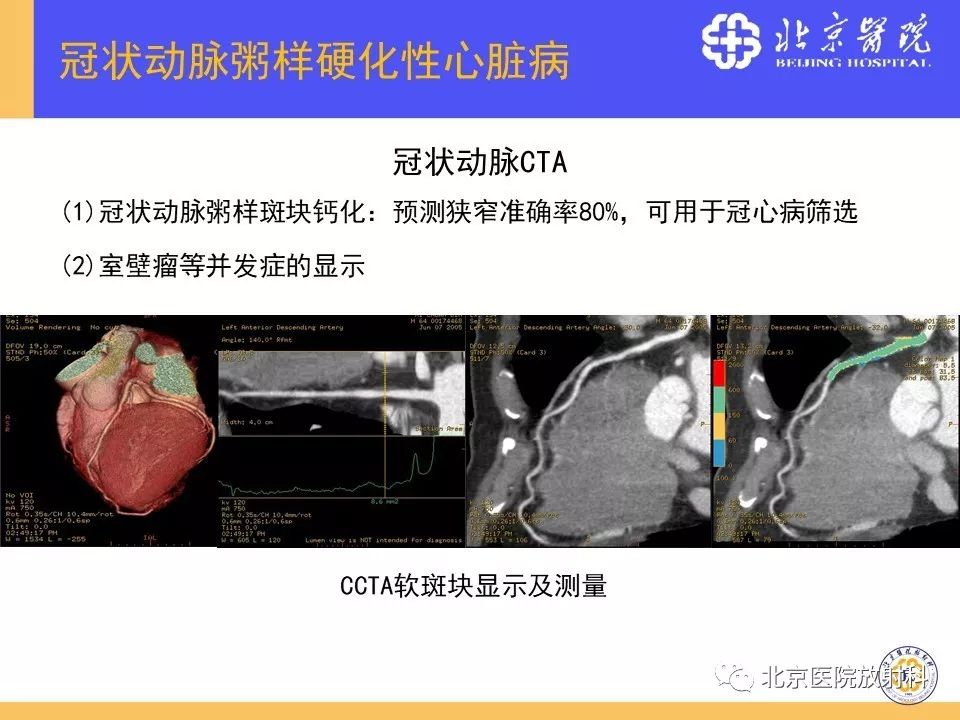 【PPT】心脏病变的影像诊断