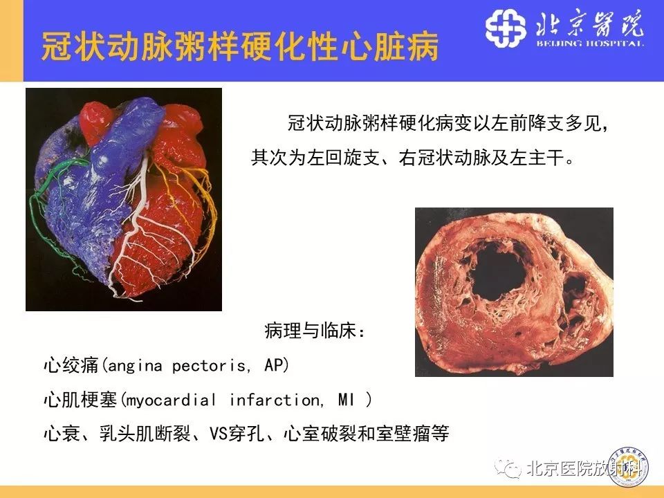 【PPT】心脏病变的影像诊断