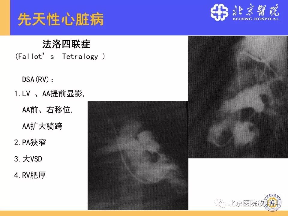 【PPT】心脏病变的影像诊断