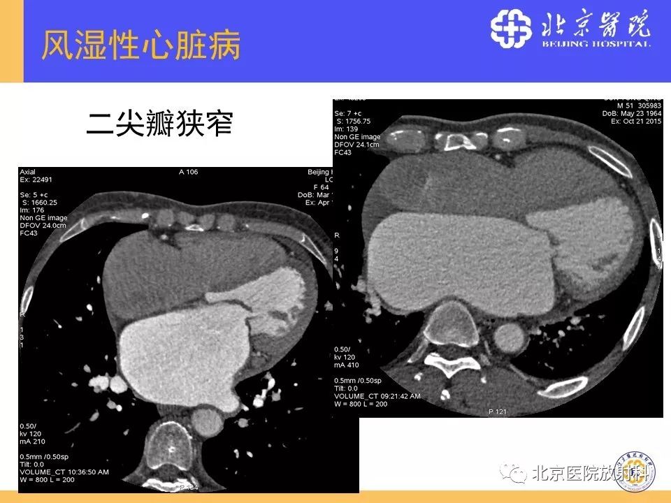 【PPT】心脏病变的影像诊断