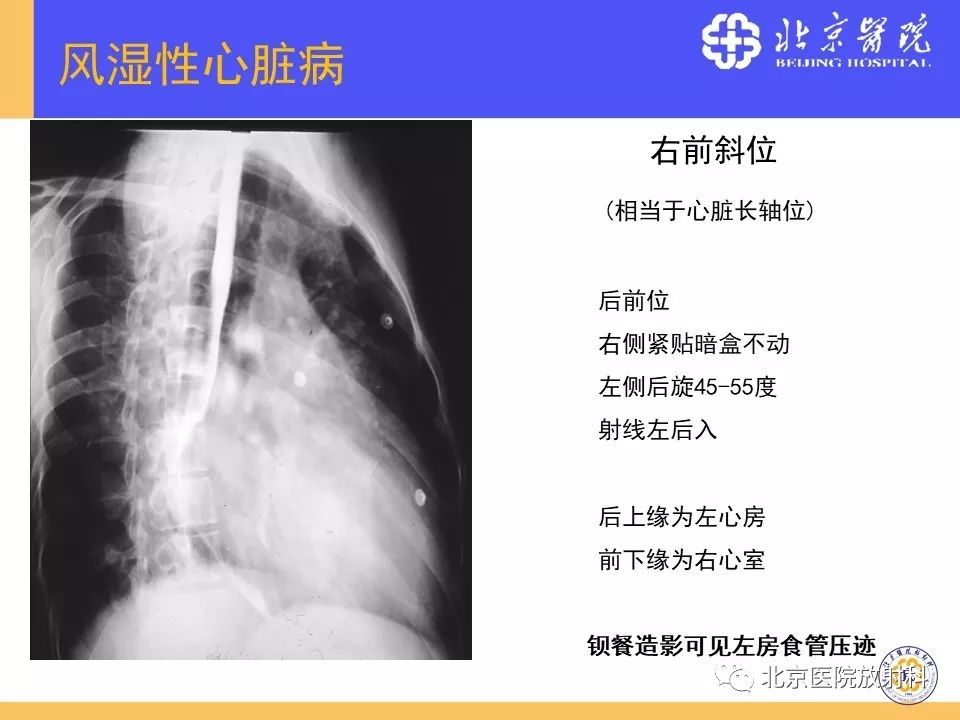 【PPT】心脏病变的影像诊断