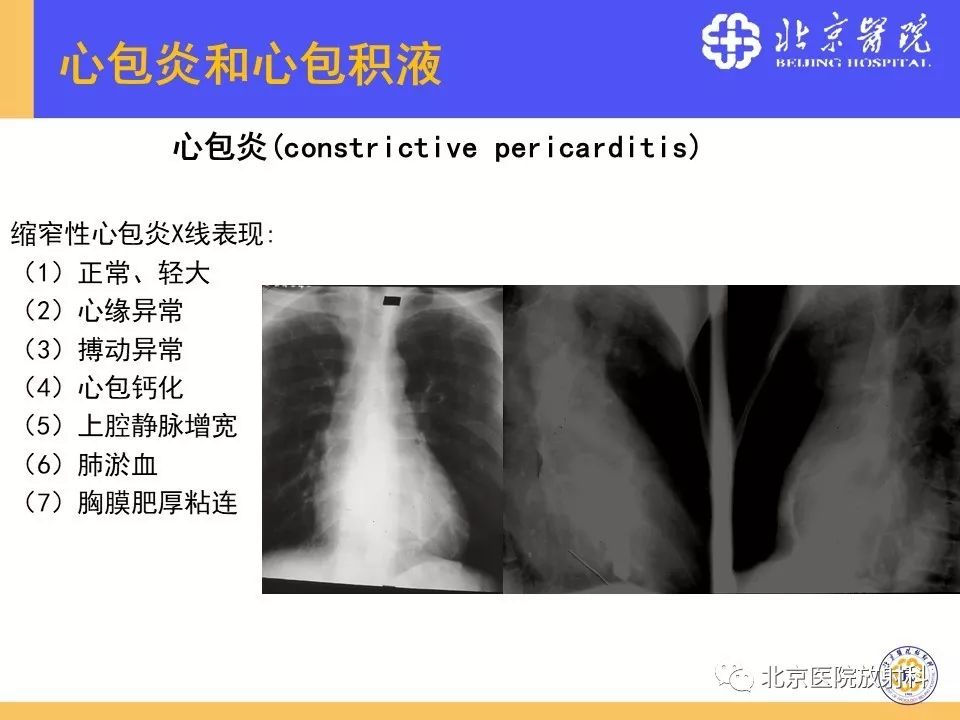 【PPT】心脏病变的影像诊断