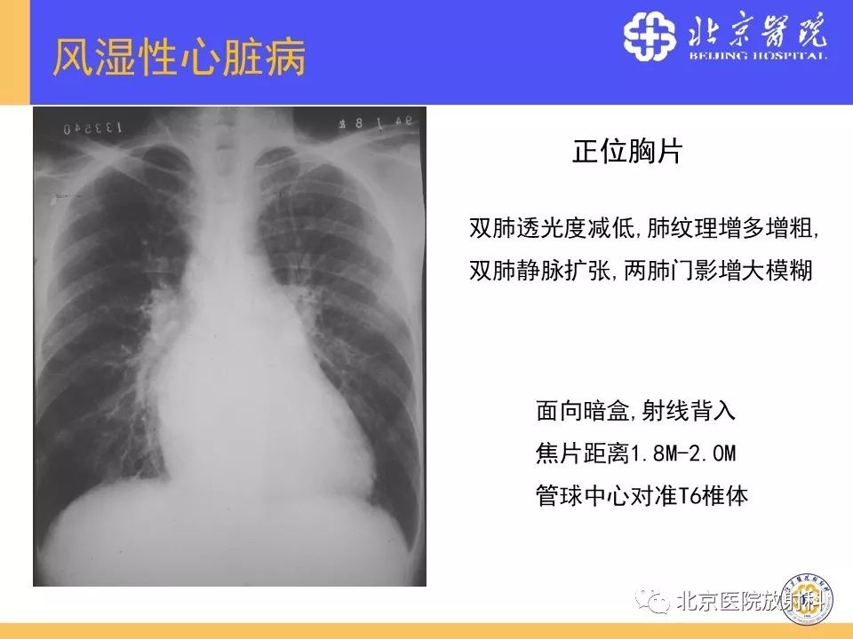 【PPT】心脏病变的影像诊断