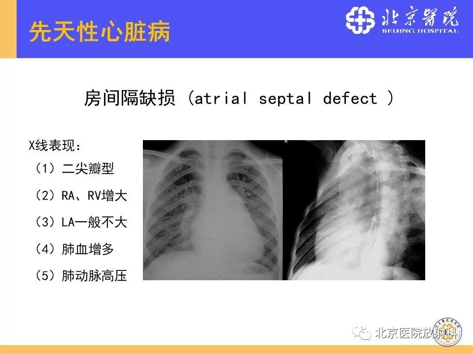 【PPT】心脏病变的影像诊断