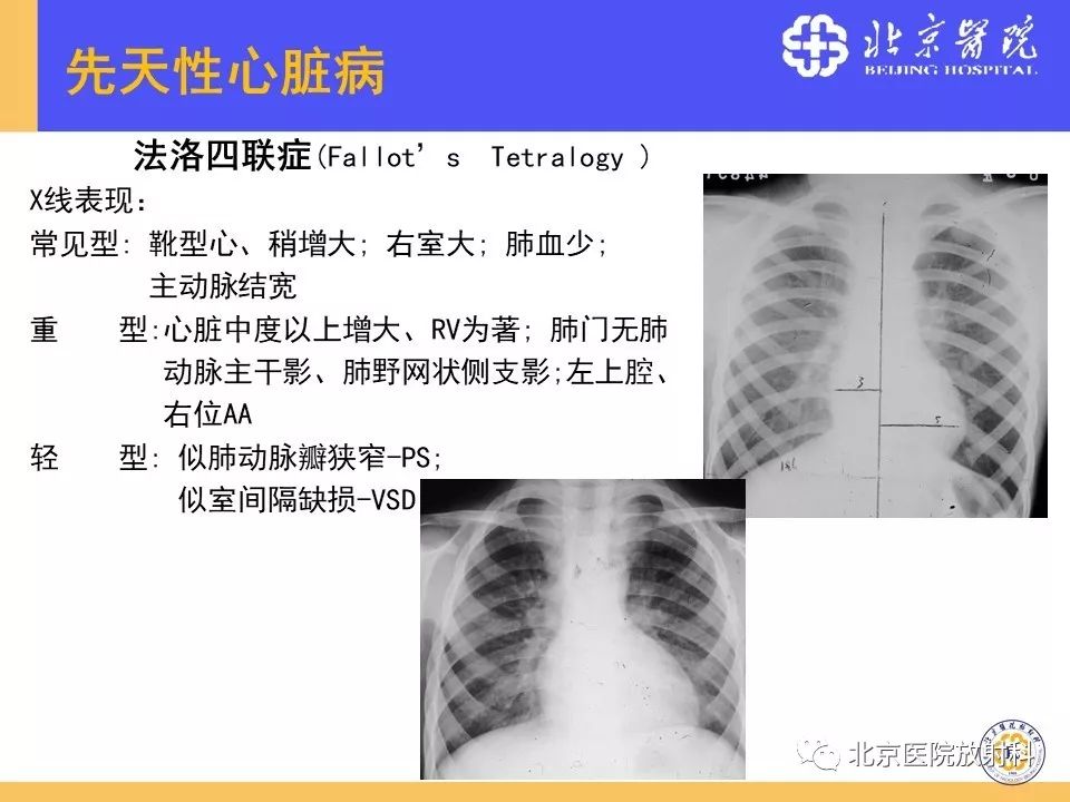【PPT】心脏病变的影像诊断